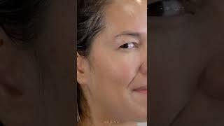 The Benefits of VI Peel Explained by Nurse Natalia