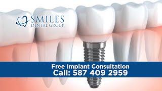 Free Dental Implant Consultation