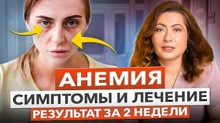 Анемия: причины, симптомы, лечение. Почему не получается поднять уровень железа?