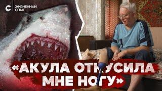 «Вместо ноги только кость торчит». Пережил нападение акулы