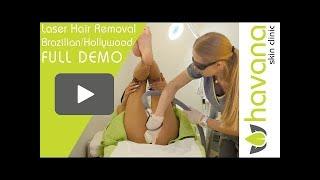 Laser Hair Removal Brazilian Full Demo training