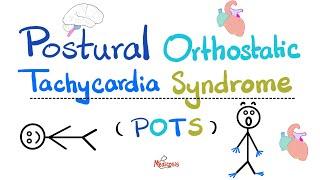 Postural Orthostatic Tachycardia Syndrome (POTS) - Causes, Symptoms, Diagnosis, Treatment-Cardiology