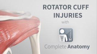 Rotator Cuff Injuries | Complete Anatomy