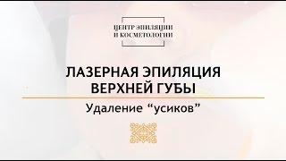 Лазерная эпиляция верхней губы. Центр эпиляции и косметологии Казань