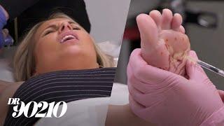 Patient Who Sweats Excessively Learns Injections Hurt Like a Bitch! | Dr. 90210 | E!