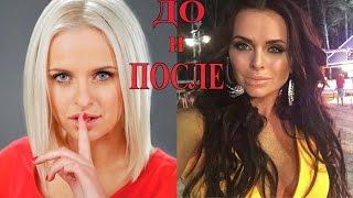 Дом 2 Участницы до и после пластики!