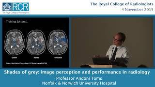 Shades of grey: image perception and performance in radiology