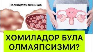 ТУХУМДОН ПОЛИКИСТОЗИ СИНДРОМИ ВА ДАВОЛАШ УСУЛЛАРИ