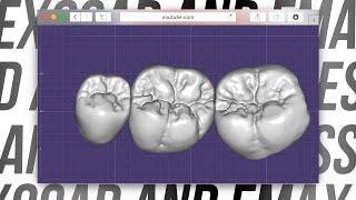 EXOCAD and emax press