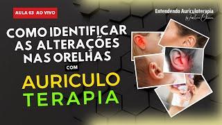 #3 - Agora ficou fácil: Como identificar Alterações nas Orelhas com a AURICULOTERAPIA AVALIATIVA