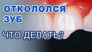 Что делать если ОТКОЛОЛСЯ кусок зуба? / Откололся зуб: как восстановить?