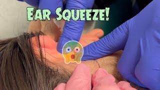NEW! Oreo's Juicy Ear Pop - Big Bump Behind the Ear