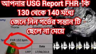 FHR কতো থাকলে ছেলে হয় Original Report|Baby Boy Symptoms During Pregnancy Bengali#baby#FHR#pregnancy