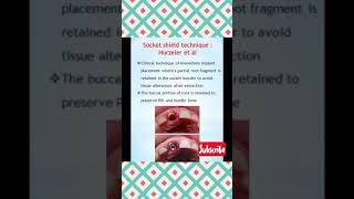 Prosthohub #socket shield technique #YouTube Shorts