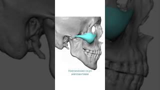 Увеличение скул имплантами https://instagram.com/365plastics_korea #медтуризмвкорее #лечениевкорее