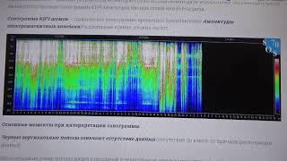 7.12.24 г.Послабление после 3 х суток, Значение слова Космонавты.