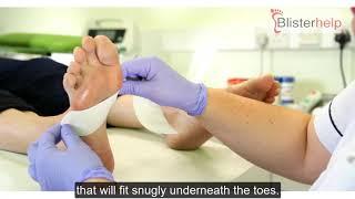 How to apply Hypafix Tape for Blister Prevention