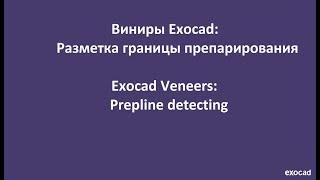 Виниры Exocad: 1) разметка границ препарирования  /  Veneers Exocad: 1) prepline detecting