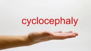 How to Pronounce cyclocephaly - American English