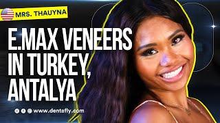 e.Max Veneers in Turkey, Antalya |  Thauyna Fox from