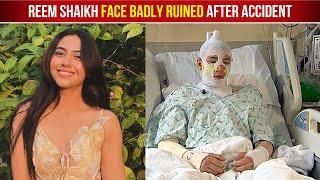 Reem Shaikh Badly Injured And Admitted To Hospital After Hot Oil Splash All Over Her Face