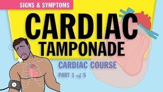 Cardiac Tamponade: Pathophysiology & Symptoms for Nursing Students & NCLEX (1 of 5)