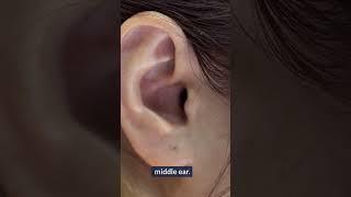 Tinnitus EXPOSED - Surprising Causes of Ringing in Ears #3