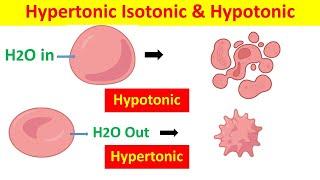 Hypertonic, Hypotonic, and Isotonic Solutions and Their Effects on Cells