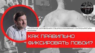 Судебно-медицинская экспертиза: обращаться в институции или самостоятельно фиксировать побои?