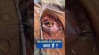 What Is Bladeless Lasik?