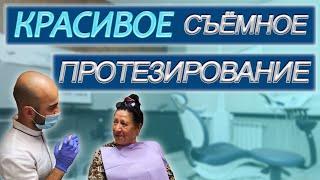 Красивое съемное протезирование. ПРИЕМ У СТОМАТОЛОГА В СОЧИ. Сделать ЗУБЫ В СОЧИ.