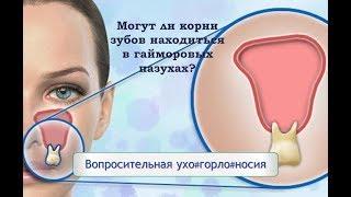 Могут ли корни зубов находиться в гайморовых пазухах?