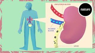 Acute kidney injury explained