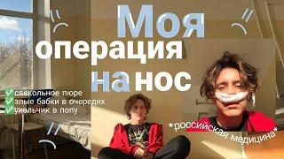 моя операция на нос