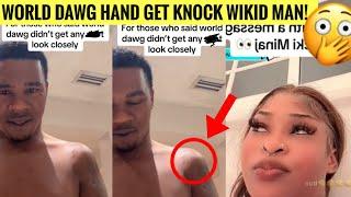 BLAMDEM Fault Nicki Minaj Get RUSH! World Dawg GVNSH0T W0UNDS REVEALED FOR THE FIRST TIME!