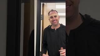 Hair Transplant to Results in 1 Minute