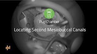 Helse Ultrasonic Endo - Pulp Chamber - Locating Second Mesiobuccal Canals