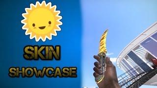 INSANE CS:GO SKIN SHOWCASE  |  LOADOUT
