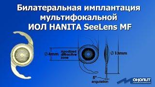 Опыт билатеральной имплантации мультифокальной ИОЛ Hanita SeeLens MF