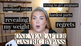 ONE YEAR AFTER GASTRIC BYPASS UPDATE
