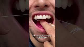 Como passar fio dental