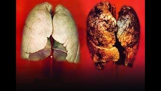 Tips Menghilangkan Nikotin Dalam Tubuh Secara Alami