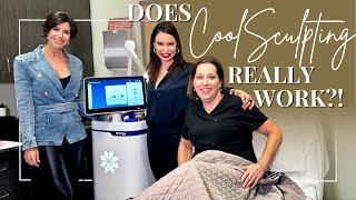 Freezing Fat Cells With The New CoolSculpting Elite | Fully Explained | Live Demo | Dominique Sachse