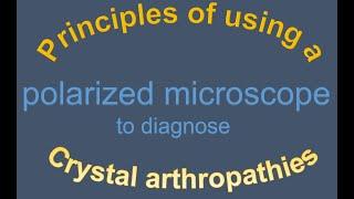 Principles of using a polarized microscope to diagnose Crystal arthropathies.