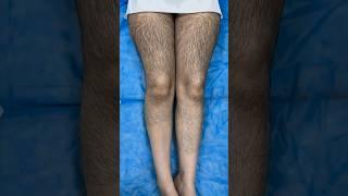 Waxing Hairy Legs #health #shortvideo #youtibeshorts #waxing #shorts #hair