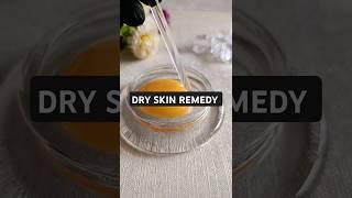 How to treat dry skin naturally. #dryskin #dryskintreatment #naturalskincare