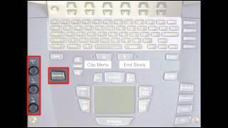 Primer on knobology for the M-Turbo SonoSite system