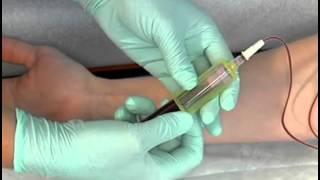 Sample Procedure - Venipuncture Butterfly Method