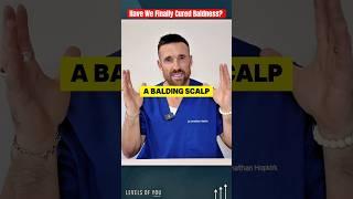 Have we finally cured baldness with PP405? (full video teaser) #hairloss #PP405 #hair #haircare