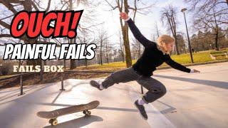 Broken Bones & PAINFUL FAILS : Fails Of The Week